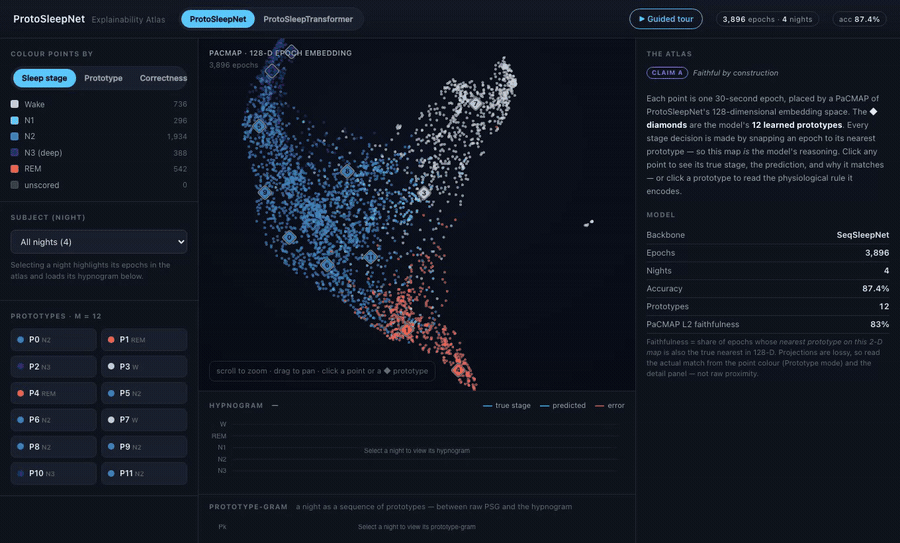 ProtoSleepNet interactive explainability demo